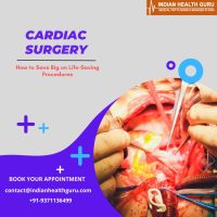 Affordable Heart Surgery  How to Save Big on Life-Saving Procedures.jpg